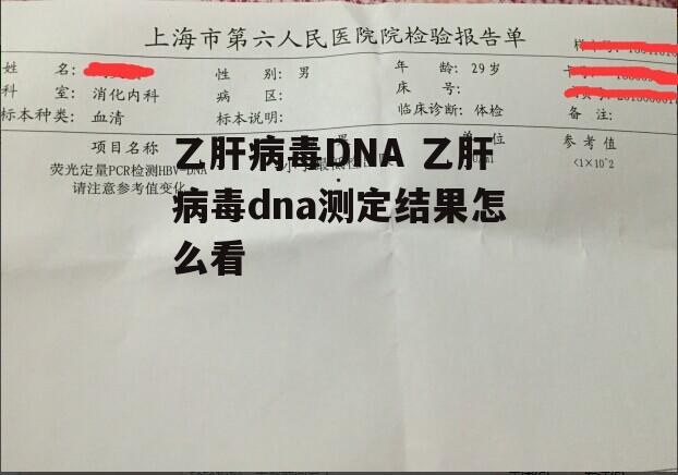 乙肝病毒DNA 乙肝病毒dna测定结果怎么看